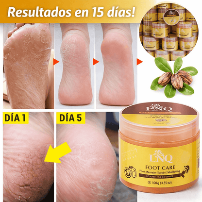 BIOAQUA™ – Exfoliante Reparador de Talones - MERKATODOSV