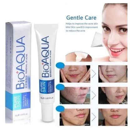 Crema Antiacné Bioaqua – Elimina Granos y Cicatrices - MERKATODOSV