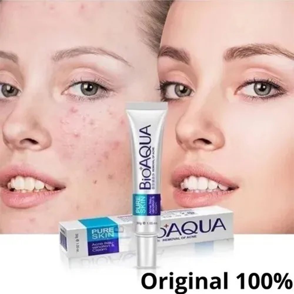 Crema Antiacné Bioaqua – Elimina Granos y Cicatrices - MERKATODOSV