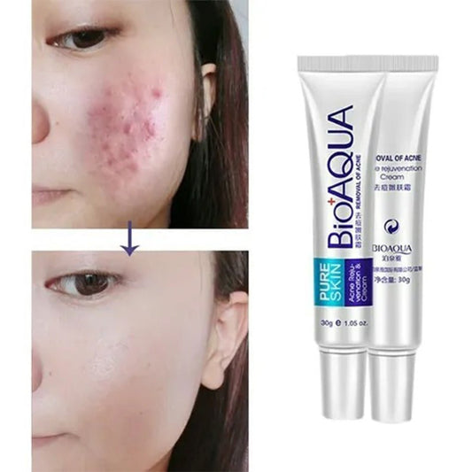 Crema Antiacné Bioaqua – Elimina Granos y Cicatrices - MERKATODOSV