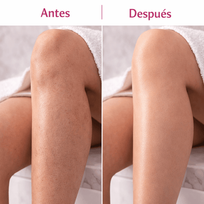 Kingyes™ - Spray Depilatorio Sin Dolor | 100% Original ✨ - MERKATODOSV