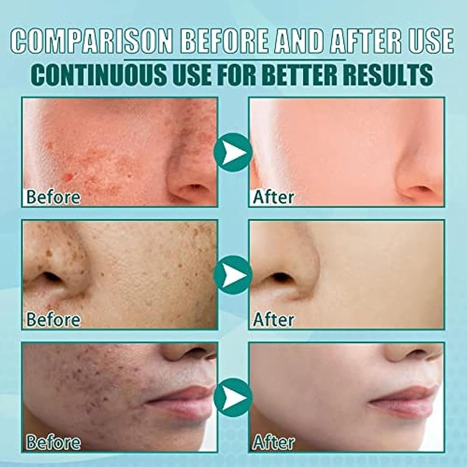 Melasma Japan™ Crema Japonesa Anti-Manchas 🇯🇵✨ - MERKATODOSV