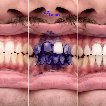 Purple Toothpaste Gel V34 | El Abrillantador Dental Nº1 - MERKATODOSV